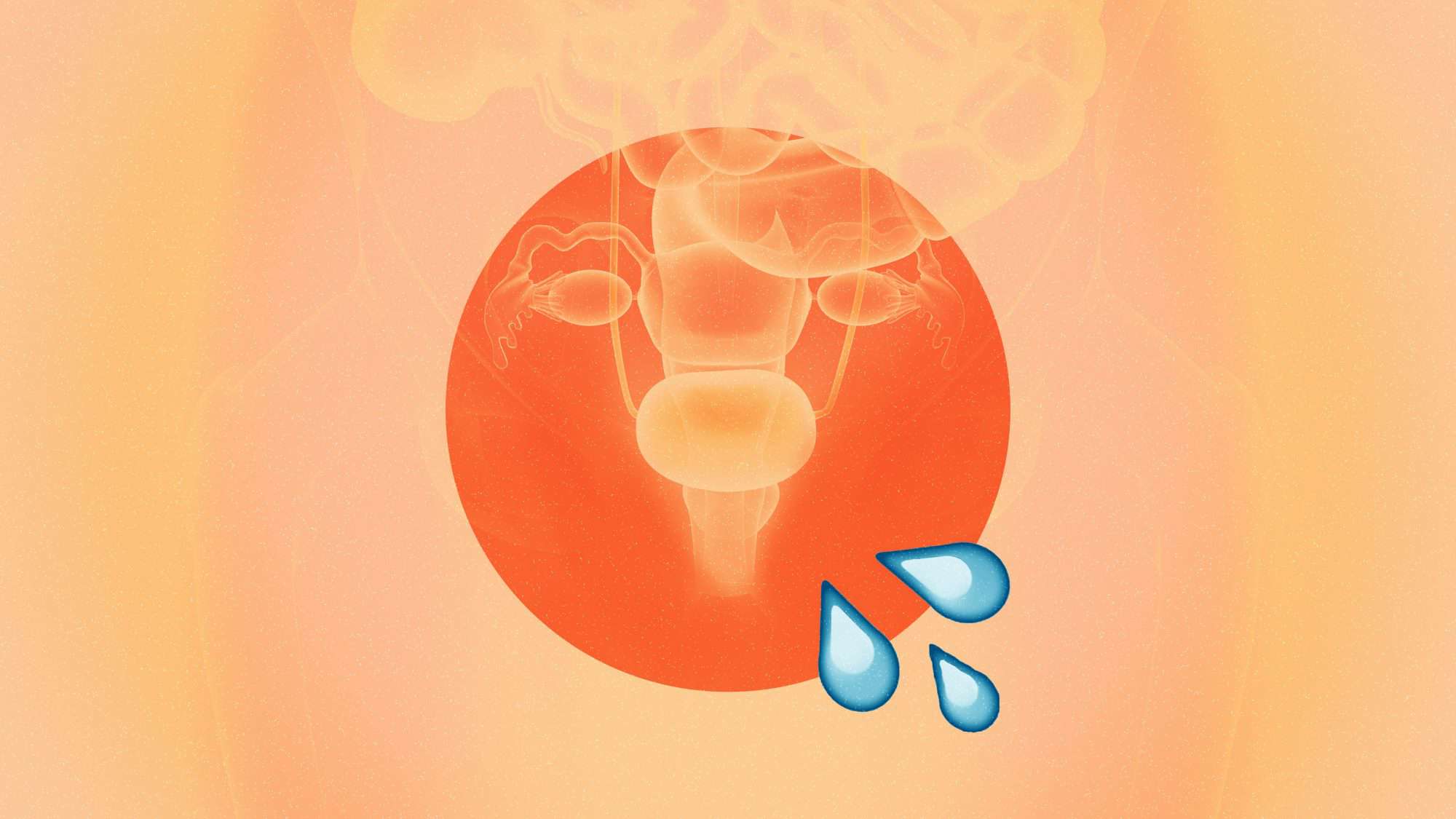 Urine Leakage Problems - Gandhi Nursing Home